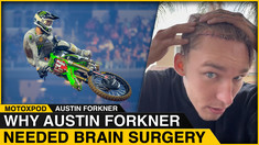 Why Austin Forkner Needed Brain Surgery 